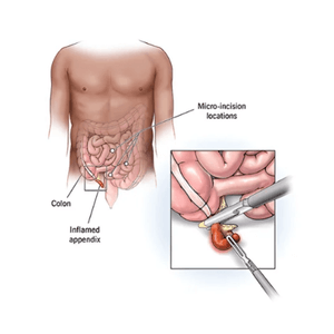 Appendix