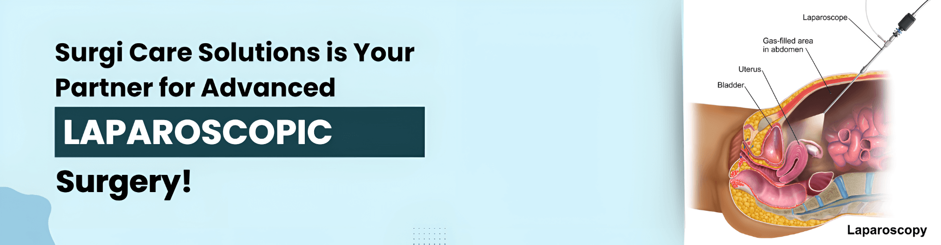 surgical care solution banner 1 (2) (1)